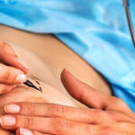 پروتز سینه چیست؟