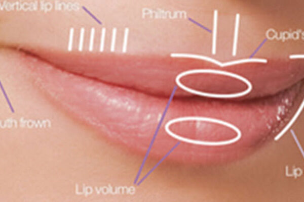 فرم دهی لب فرم دهی لب