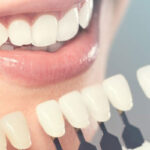 دندانپزشکی زیبایی در اهواز