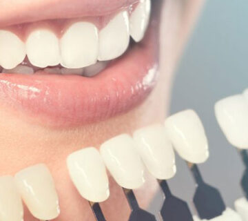 دندانپزشکی زیبایی در اهواز