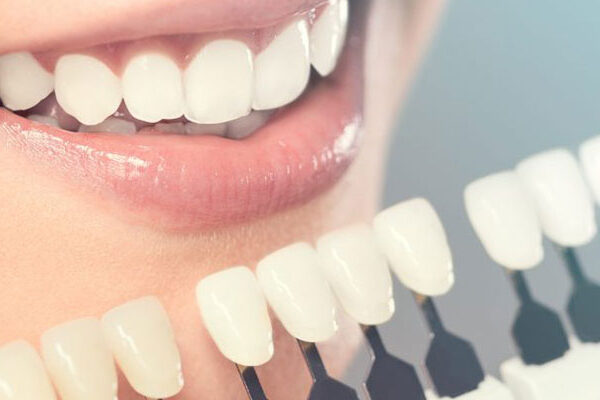 دندانپزشکی زیبایی در اهواز دندانپزشکی زیبایی در اهواز