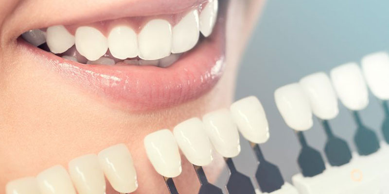 دندانپزشکی زیبایی در اهواز