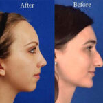 جراحی بینی در اهواز | جراح پلاستیک بینی در اهواز