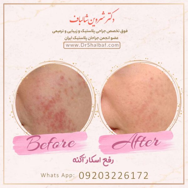 جراحی بینی در اهواز جراحی بینی در اهواز